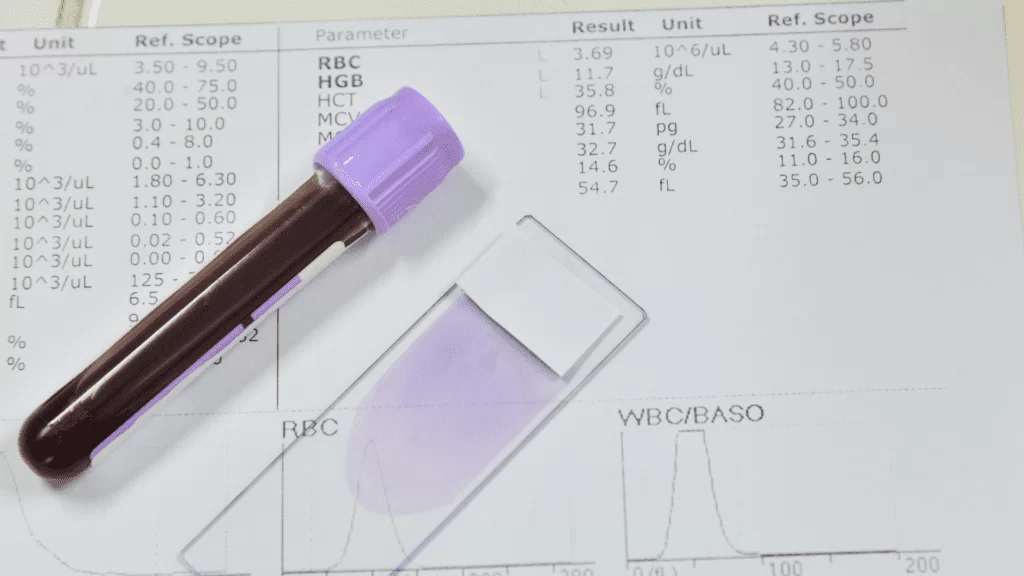 Amostra de sangue, lâmina e laudo laboratorial